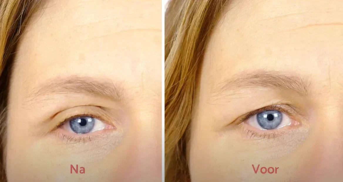 New formula: cream against sagging eyelids is in new format