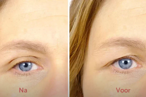 New formula: cream against sagging eyelids is in new format
