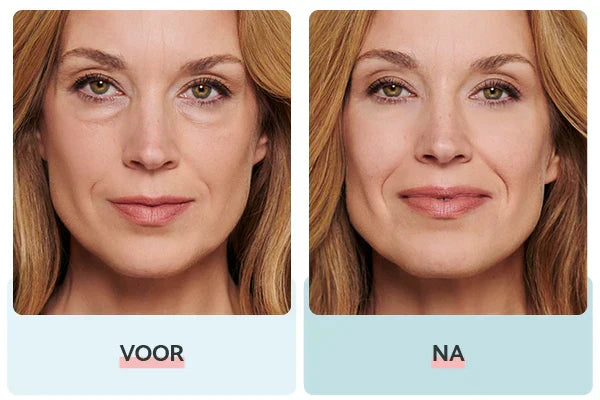 Remescar Eye Bags & Dark Circles breaks records!