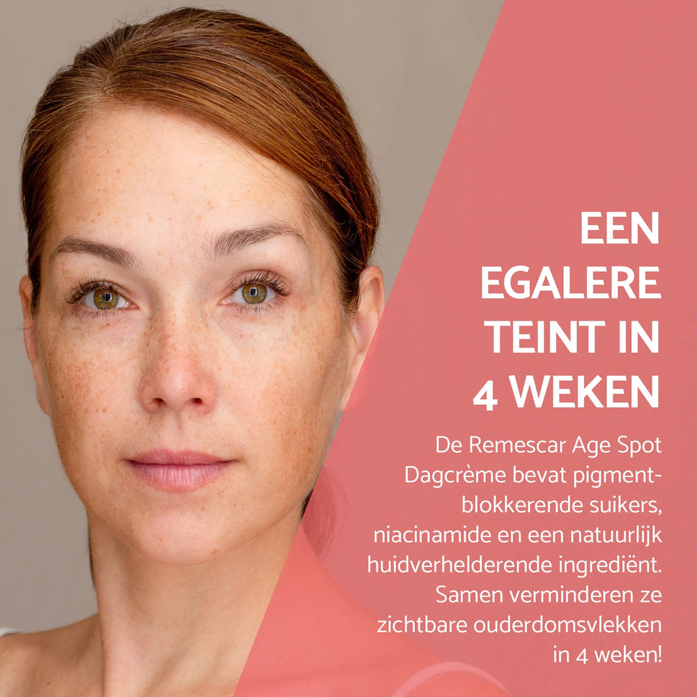 Pigmentcorrigerende Dagcrème tegen Ouderdomsvlekken – SPF 50