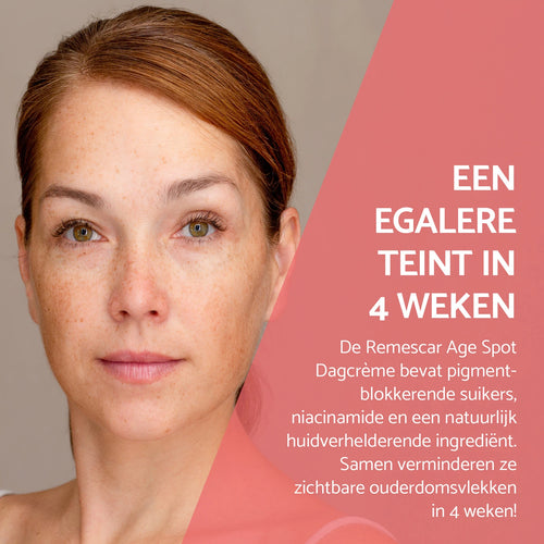 Pigmentcorrigerende Dagcrème tegen Ouderdomsvlekken – SPF 50