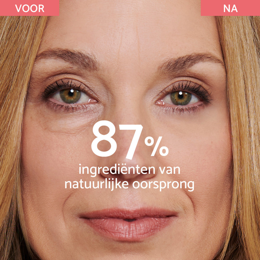 Crème voor Wallen en Donkere Kringen