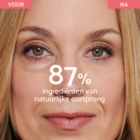 Crème voor Wallen en Donkere Kringen