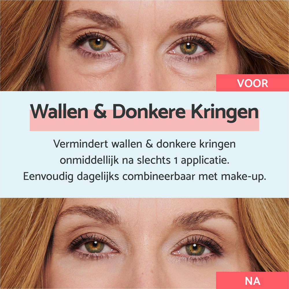 Crème voor Wallen en Donkere Kringen