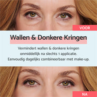 Crème voor Wallen en Donkere Kringen