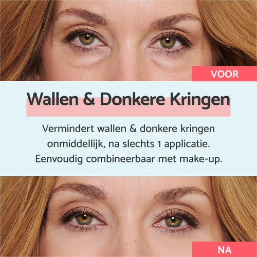 Anti-wallen & donkere kringen pakket