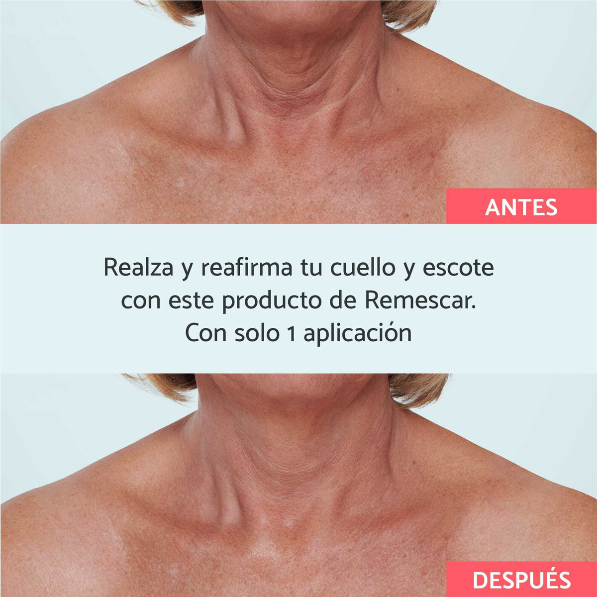 Cuello Y Escote Lifting Instant neo Remescar cuello-y-escote-lifting-instant-neo-remescar